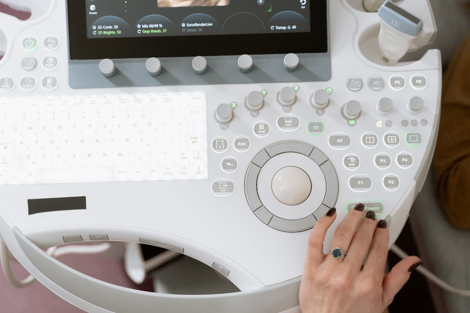Close-up of a medical professional operating modern ultrasound equipment for diagnosis.