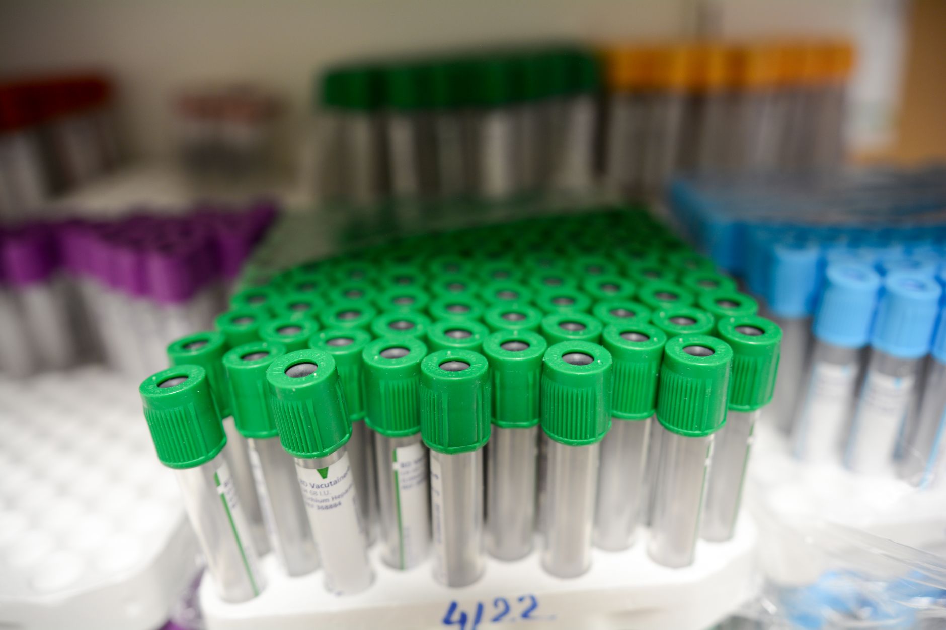 Multiple blood test vials arranged neatly in a medical lab setting, highlighting organization.